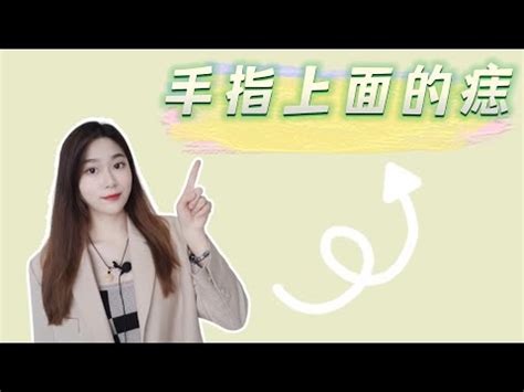 左手中指有痣|女生左手中指有痣代表什么 女生左手中指有痣好不好